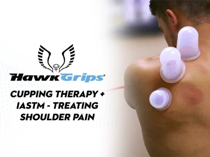 Fundamentals of Cupping and IASTM Therapy