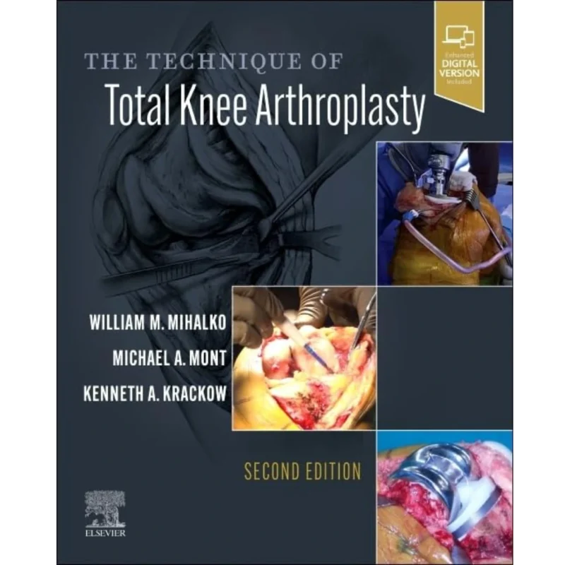 The Technique of Total Knee Arthroplasty