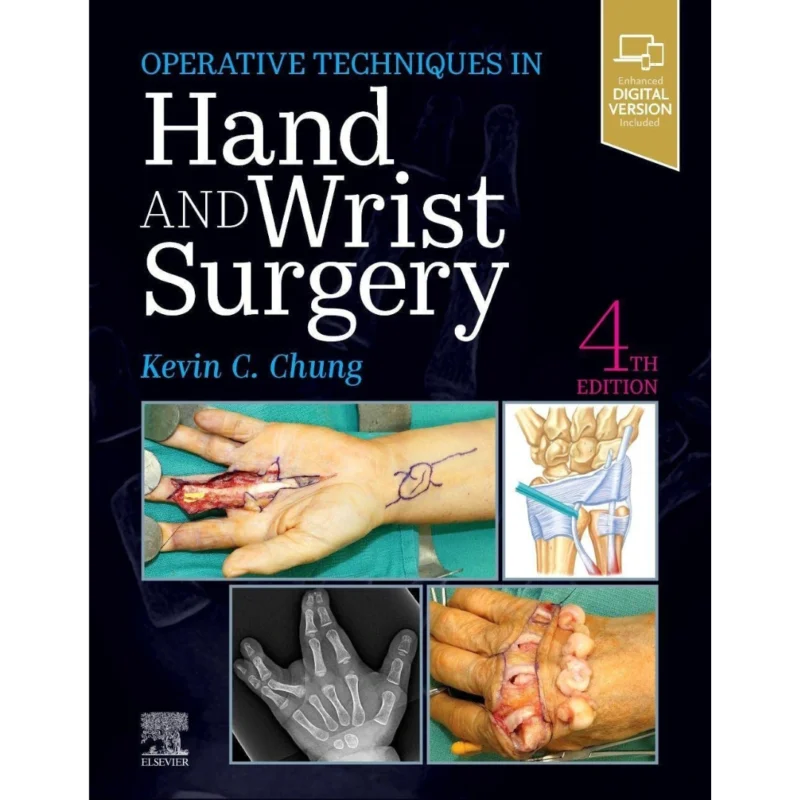 Operative Techniques: Hand and Wrist Surgery