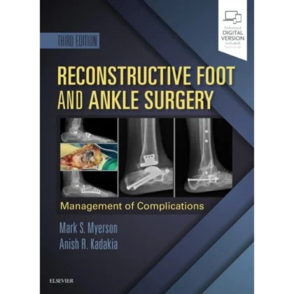 Reconstructive Foot and Ankle Surgery: Management of Complications