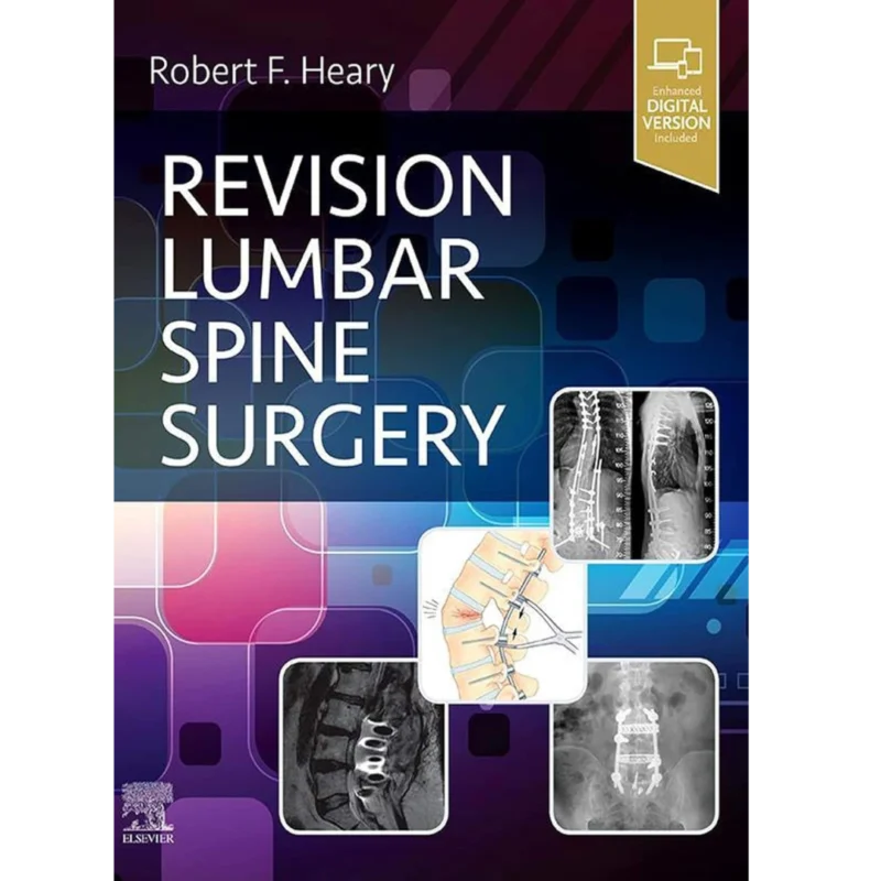 Revision Lumbar Spine Surgery