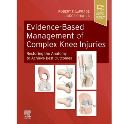 Evidence-Based Management of Complex Knee Injuries: Restoring the Anatomy to Achieve Best Outcomes