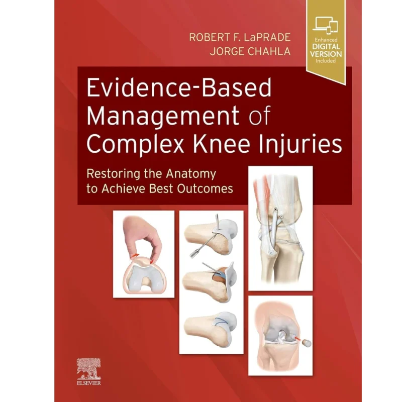Evidence-Based Management of Complex Knee Injuries: Restoring the Anatomy to Achieve Best Outcomes